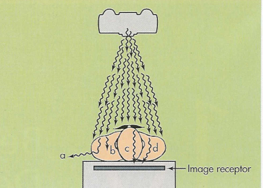 <p><span><span>change in direction of the x-ray photon after interaction with the atoms of the patient </span></span></p>