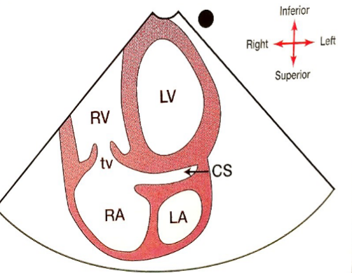 <p>What new structure can be seen if tilted posteriorly?</p>