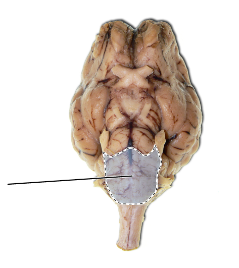 <p>Name the part of the brain that is highlighted.</p>