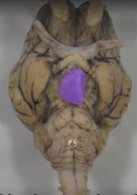 what part of the brain is this?