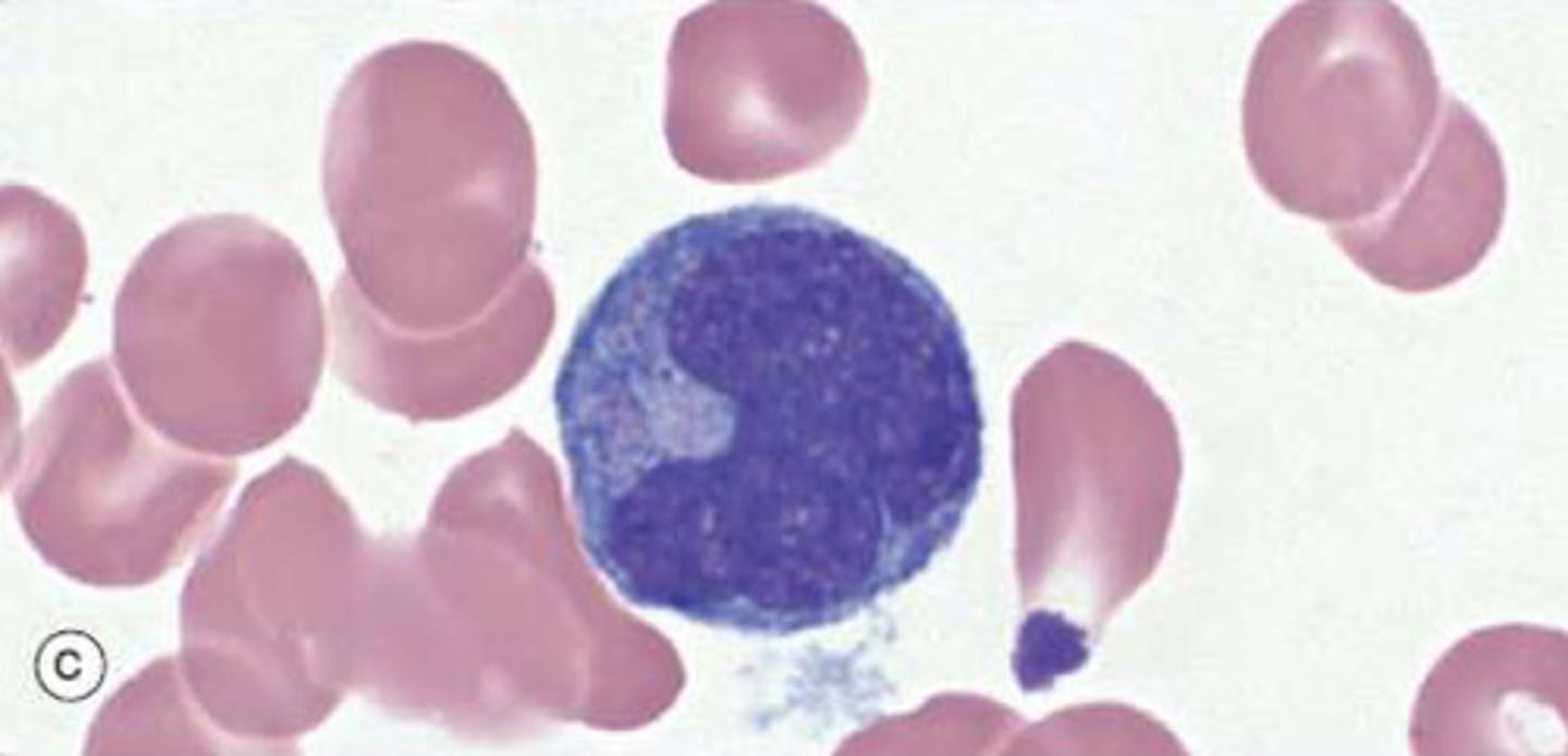 <p>Account for 2-10% of total WBC</p><p>Lifespan varies (days)</p><p>Phagocytic and pinocytic</p><p>Monocytes are 'agranulocytes' that leave circulatory system by diapedesis and mature into macrophages in tissues</p><p>15-20uM diameter</p><p>Large, kidney-shaped nucleus</p><p>Fine cytoplasmic granules contain lysosomes</p><p>Function: respond to inflammation and act as antigen-presenting cells (APCs)</p>
