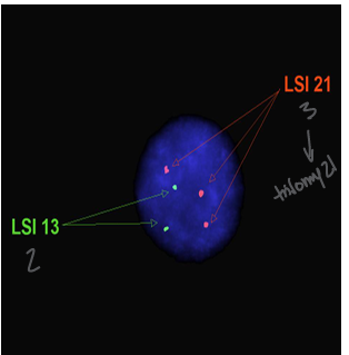 <p>-use a sequence specific probe to bind DNA to ask a specific question</p><p>-probes can be designed to bind DNA or RNA and range in size 20-1500 base pairs</p><p>-hybridization: probes bind to their complementary DNA sequences on the chromosomes</p><p>-visualization: fluorescent signals visualized under a fluorescent microscope; typically 300 interphase cells are counted</p>