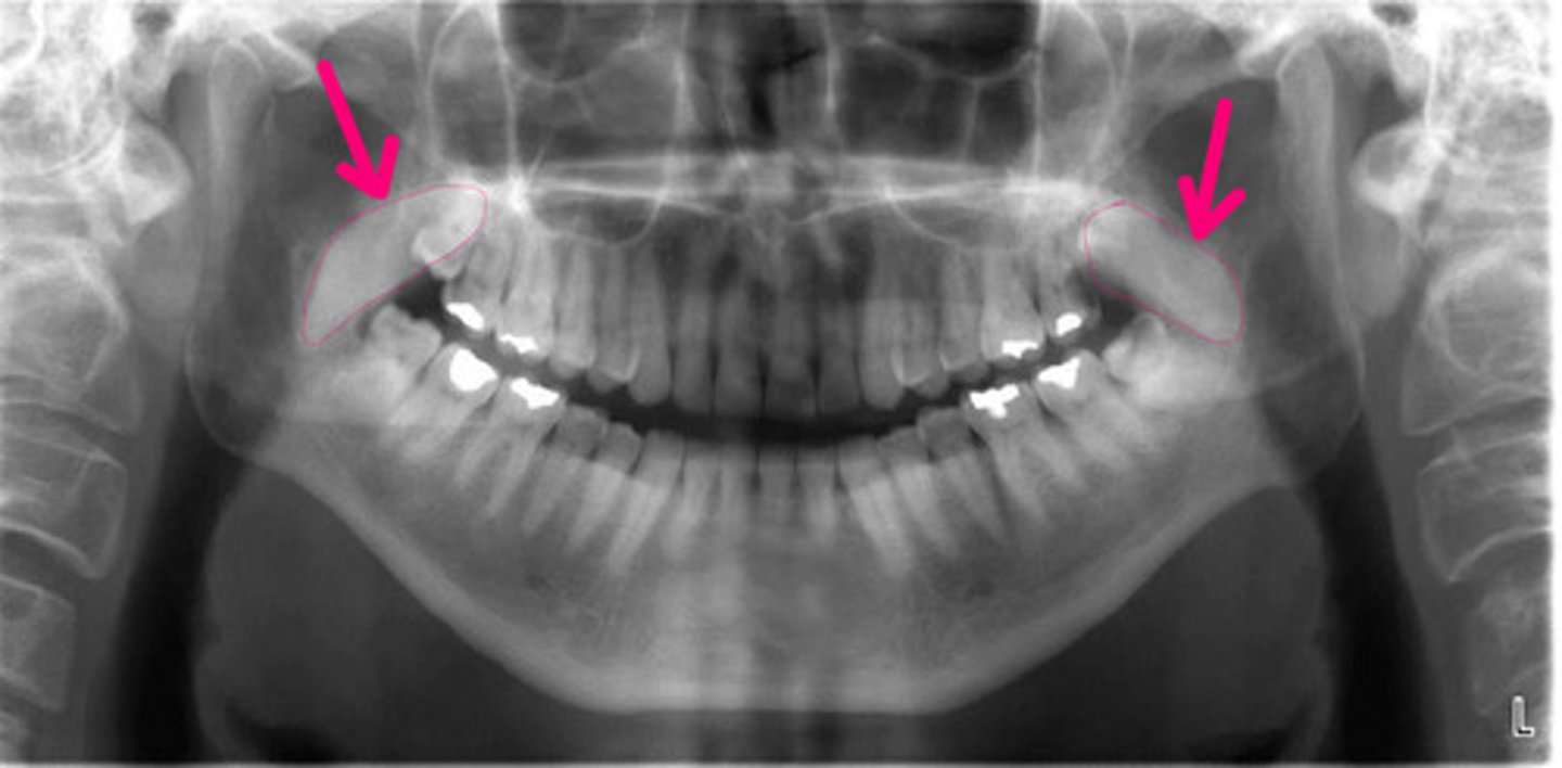 <p>Idenifty the structure.</p>