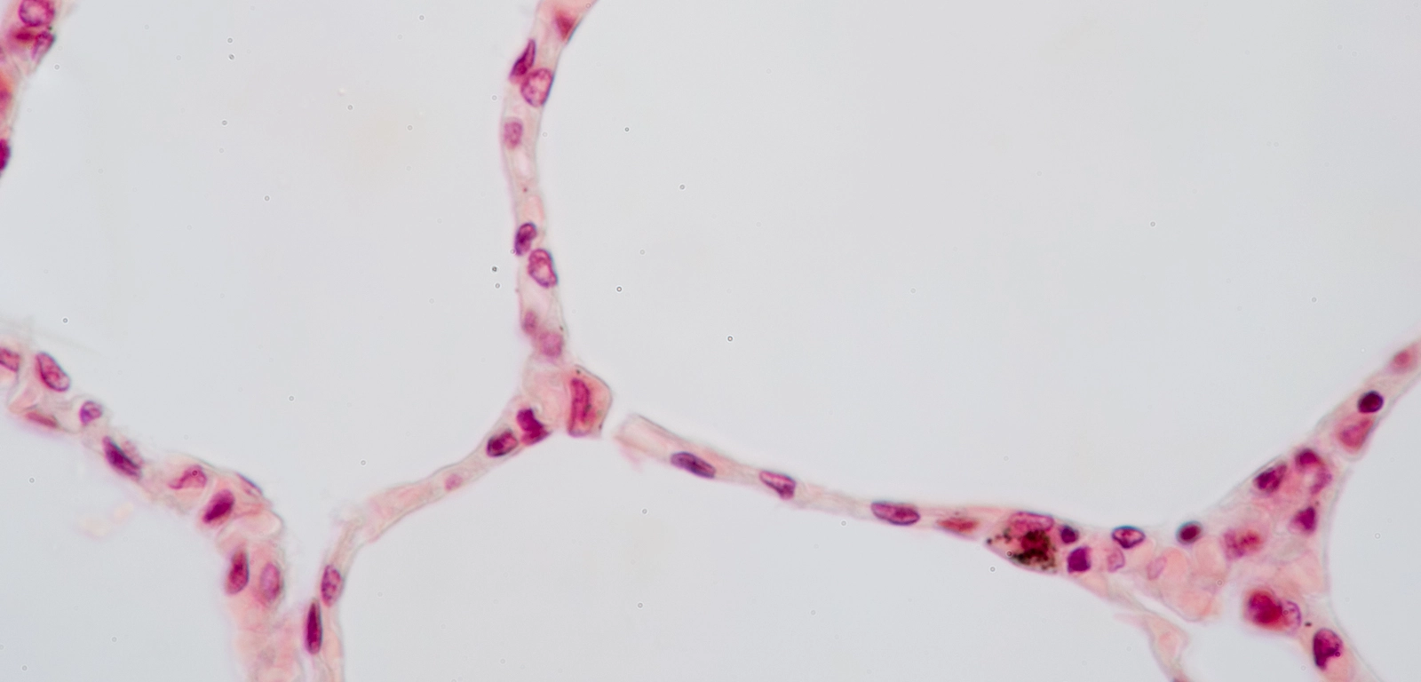 <p>What kind of Epithelia is this?</p>