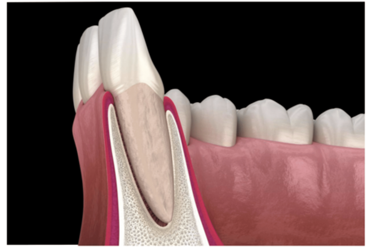 <p>The alveolar bone is a specialized part of the mandibular (lower jaw) and maxillary (upper jaw) bones with primary function to support the teeth</p>