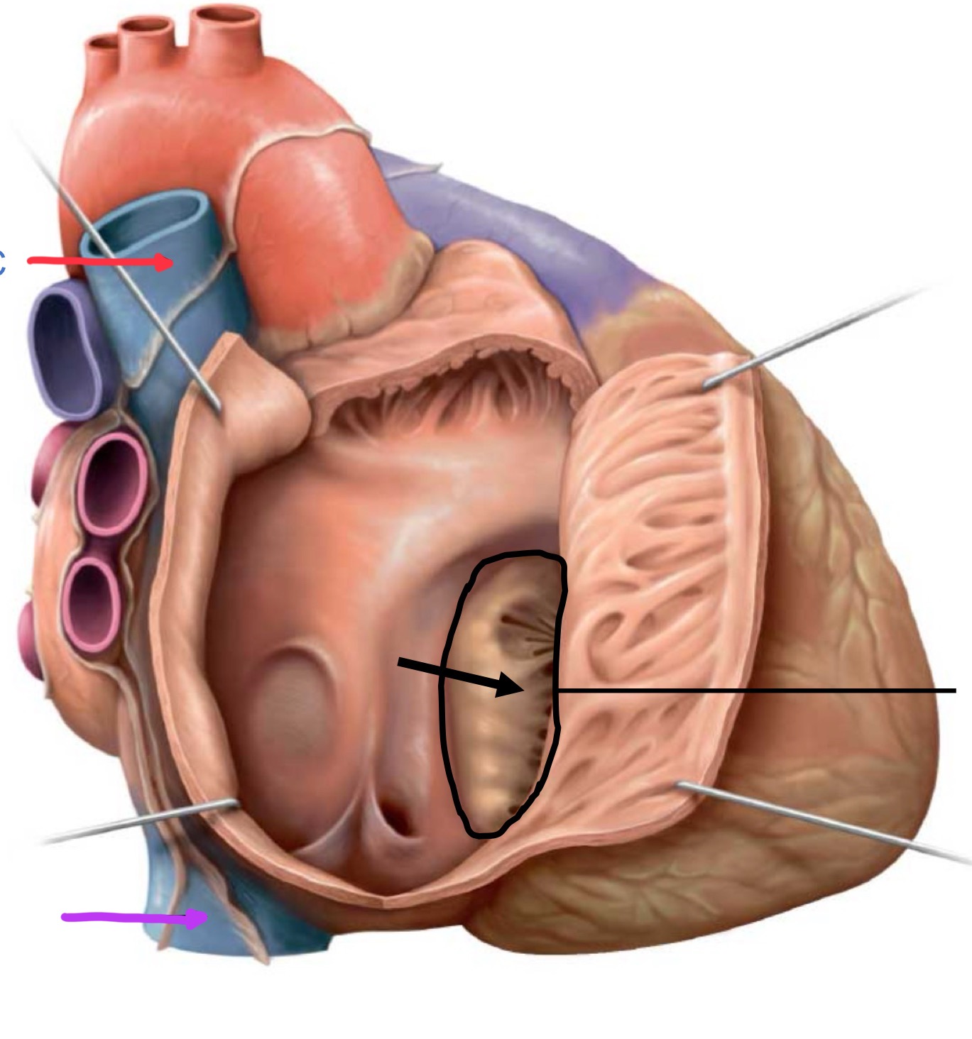 <p>What structure is identified by the red line?</p>