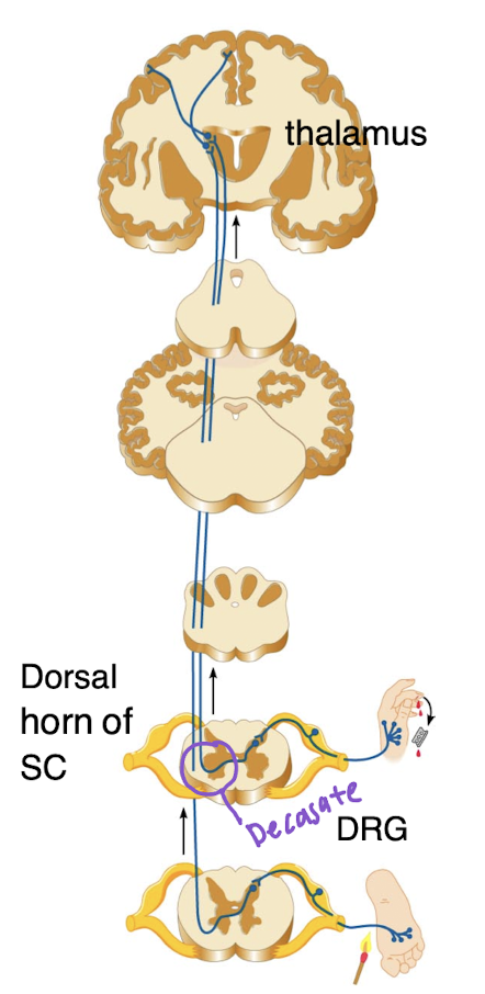 <ul><li><p>Carries information on pain and temperature and deep pressure</p></li><li><p>Pathways crossover in spinal cord</p></li></ul><p></p><p><span style="color: yellow">1st order neuron:</span>  Sensory neuron cell bodies in DRG</p><p><span style="color: yellow">2nd order neuron:</span> Dorsal horn of spinal cord’s axons decussate</p><p><span style="color: yellow">3rd order neuron:</span> Thalamus projects information to primary somatosensory area of cortex</p><p></p><img src="https://knowt-user-attachments.s3.amazonaws.com/3e470a51-d999-49e5-9d48-a5e5417b1b1b.png" data-width="100%" data-align="center"><p></p>