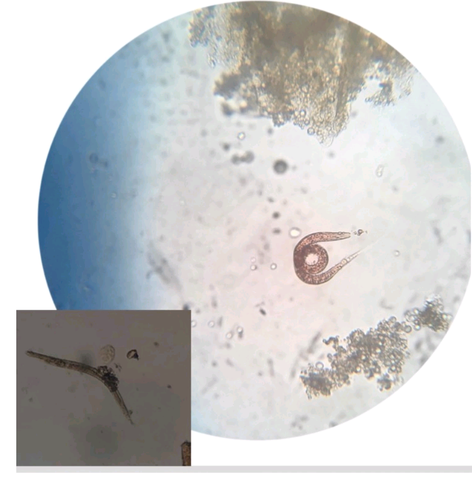 <p>Sobre o(s) parasito(s) na foto, escreva:</p><ul><li><p><strong>NOME CIENTÍFICO</strong></p></li><li><p><strong>FORMA EVOLUTIVA</strong> (+ <strong>SEXO</strong> - <u>se houver</u>)</p></li></ul>