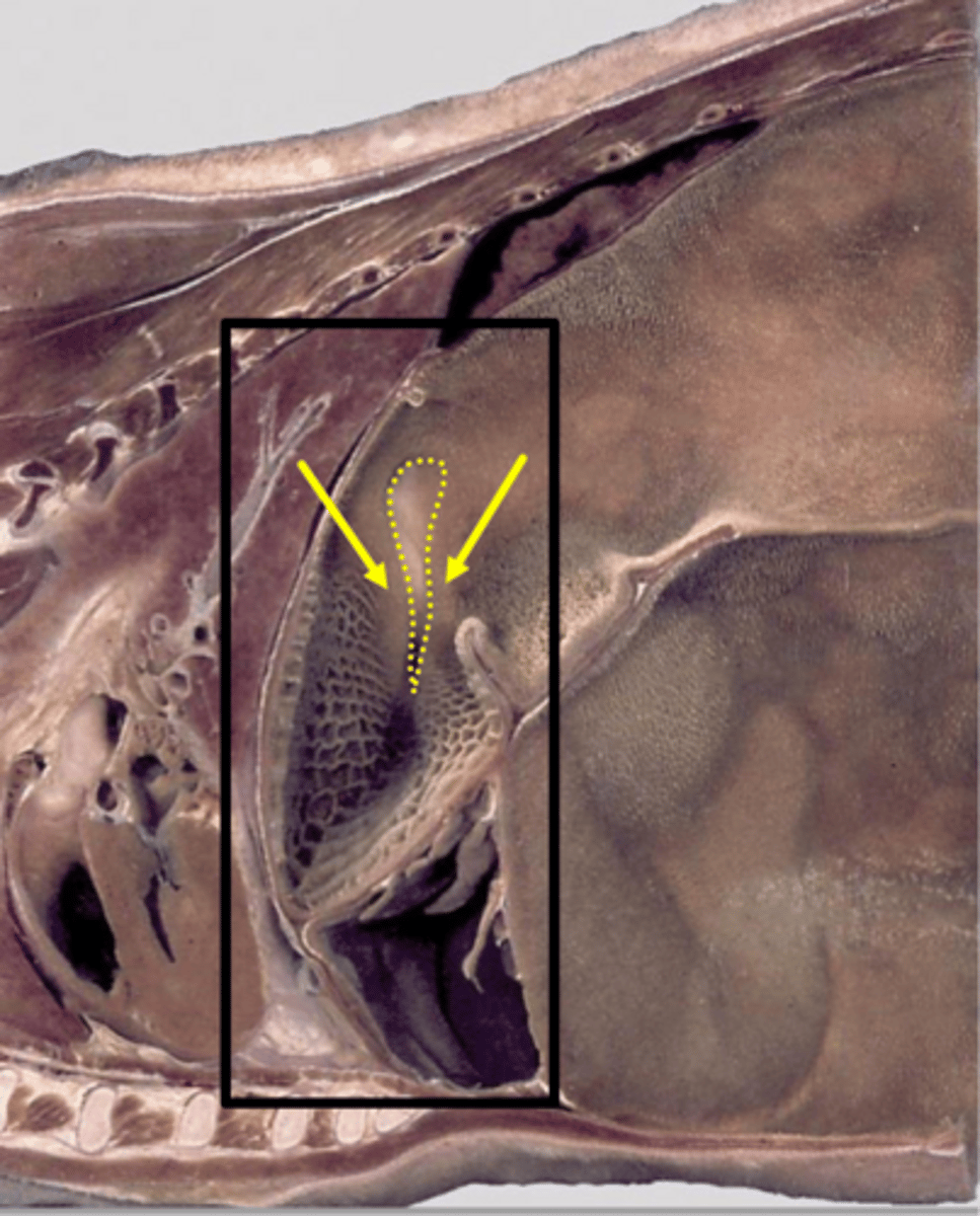 <p>what structure indicated in the image is the continuation of the cardia/esophagus within the reticulum and it bounded by the reticular lips</p>