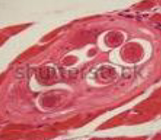<p>Trichinella Spiralis larvae</p>