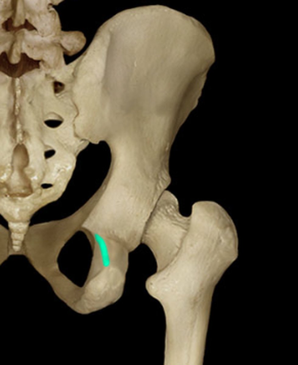 <p>Name this specific part of the pelvic bone.</p>