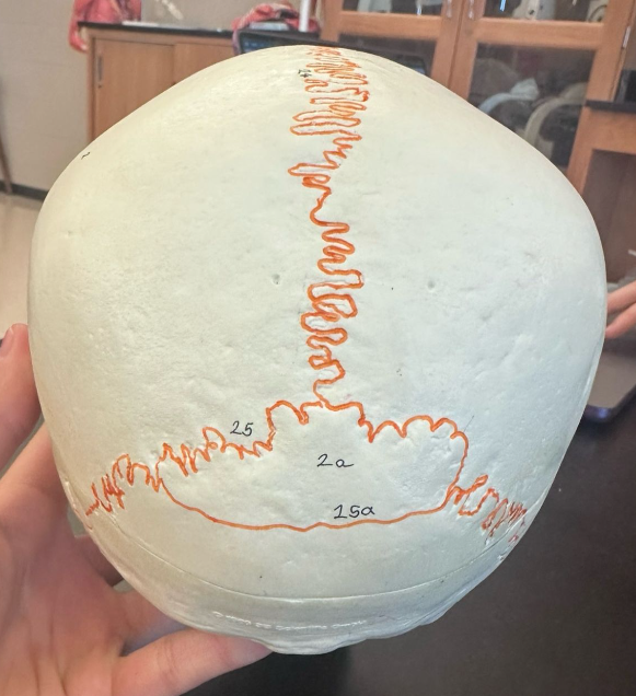 <p>What is the suture labeled 25?</p>