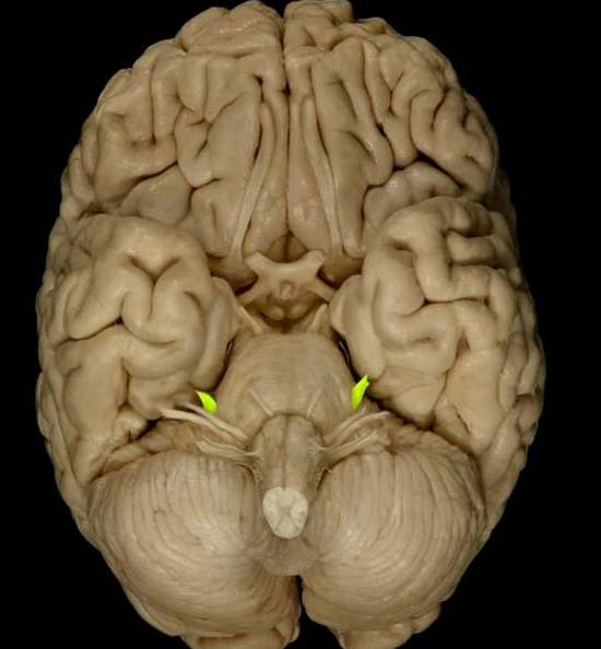 <p>List the nerve name, roman numeral, and function.</p>