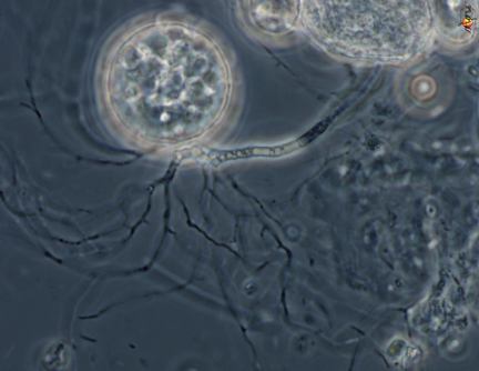 <p>which fungi group is this? is it chytrids, rhizopus stolonifer, or arbuscular mychorrizae, sac fungi, or club fungi?</p>