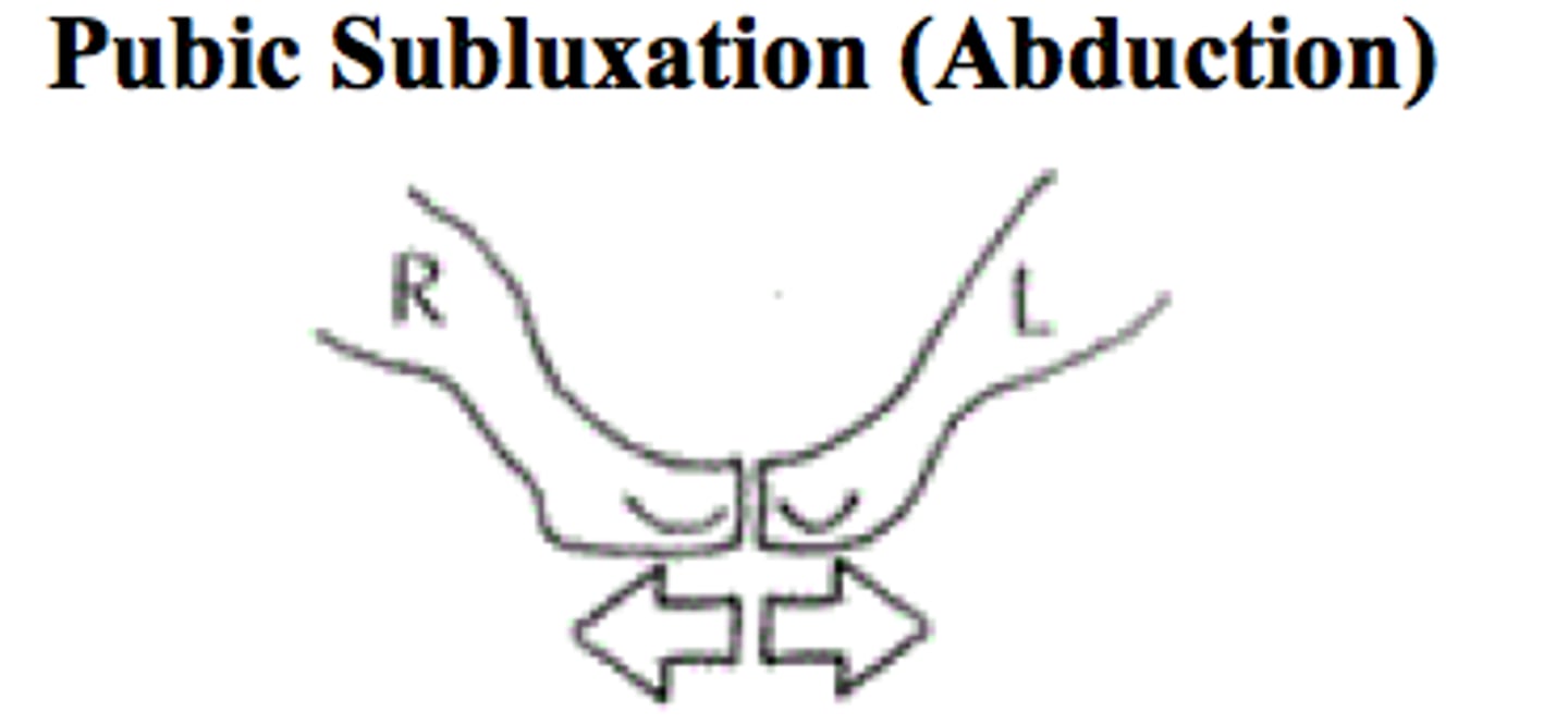 <p>ILIOSACRAL DYSFUNCTION</p><p>subluxation where the pubic bones connect</p><p>*usually superior/inferior, but can also be anterior/posterior</p><p>**common postpartum</p>