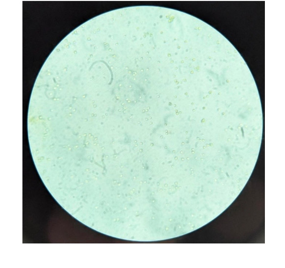 <p>What is the organism and is it prokaryotic or eukaryotic?</p>