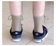 <p>Low profile - prefabricated?</p><ul><li><p>Used for the rehabilitation of ankle sprains and minor fractures.</p></li><li><p>Offers less support and stability.</p></li></ul><p></p>