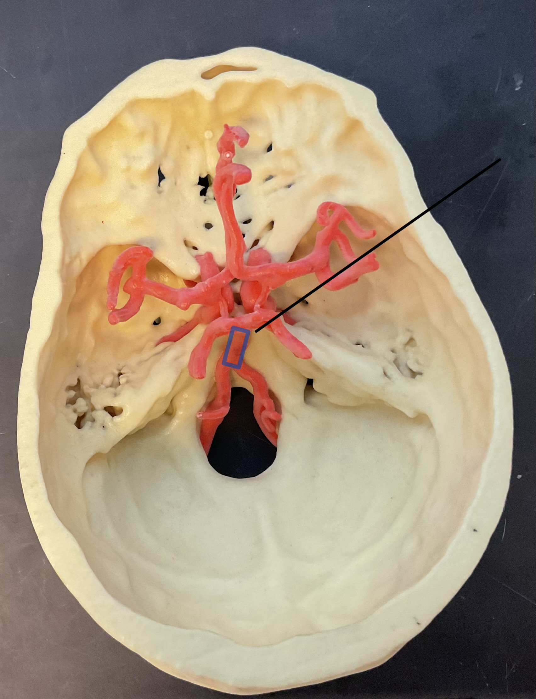 <p>Name this artery that feeds into the brain.</p>