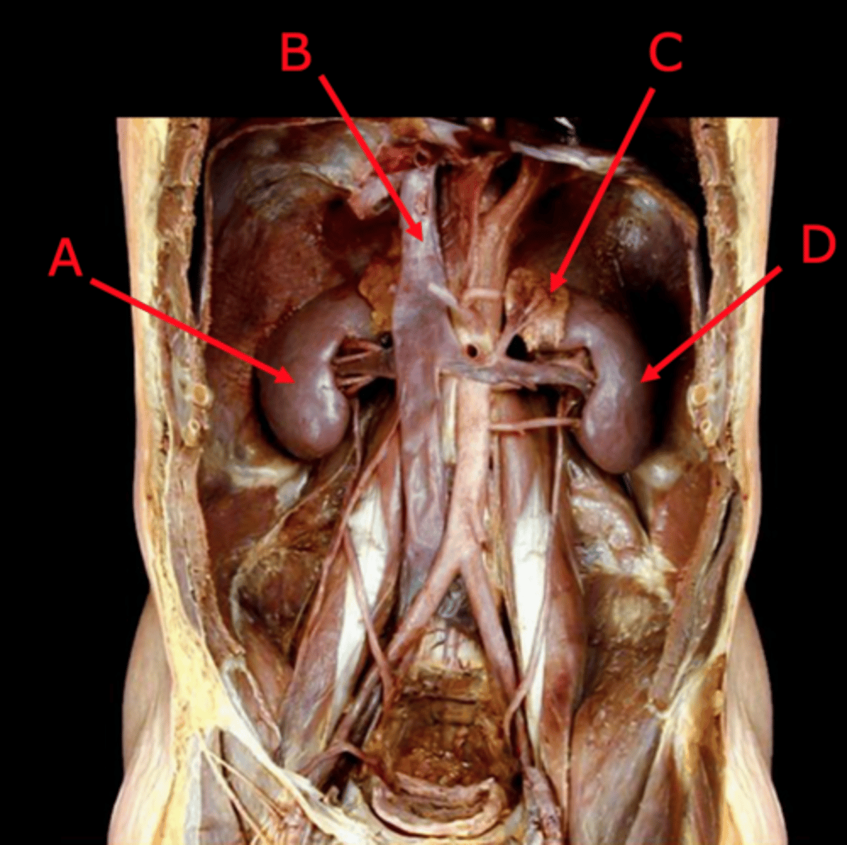 <p>ID C</p>