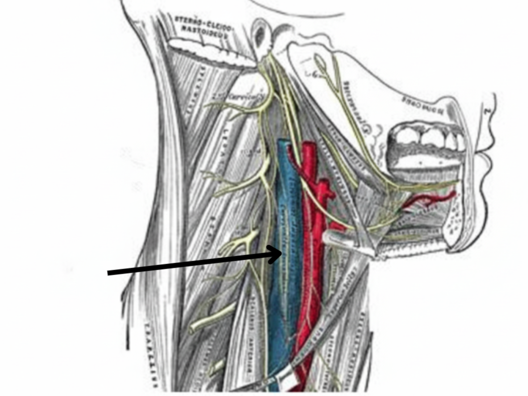 term image
