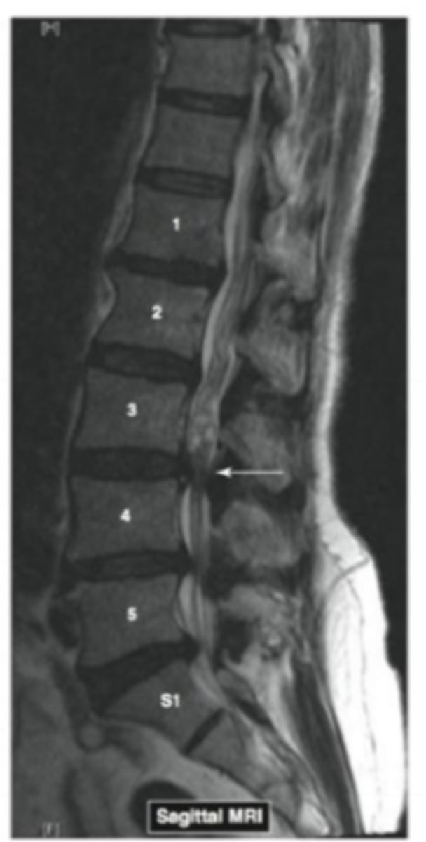 <p>Name the pathology</p>