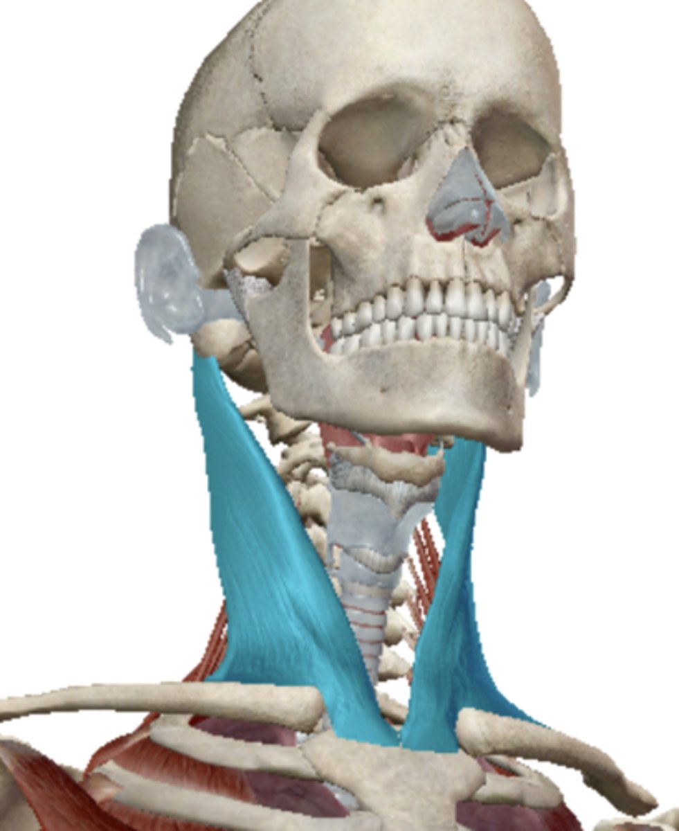 <p>Name the muscle</p>