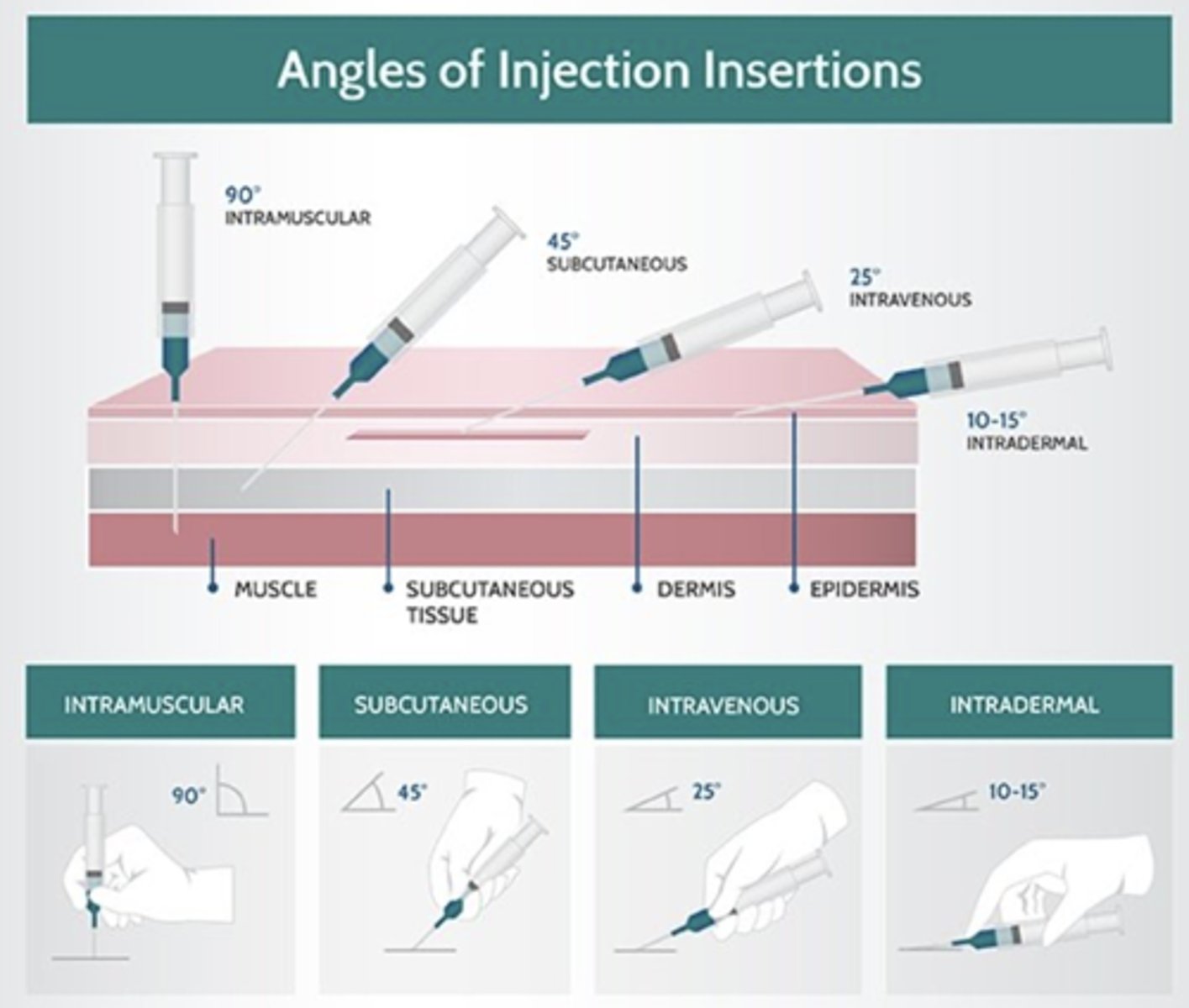 <p>Good restraint / distraction</p><p>Bevel UP</p><p>Smaller the number of needle, the Bigger the lumen (Gauge)</p><p>Match gauge to patient and drug</p><p>Aseptic Technique</p>