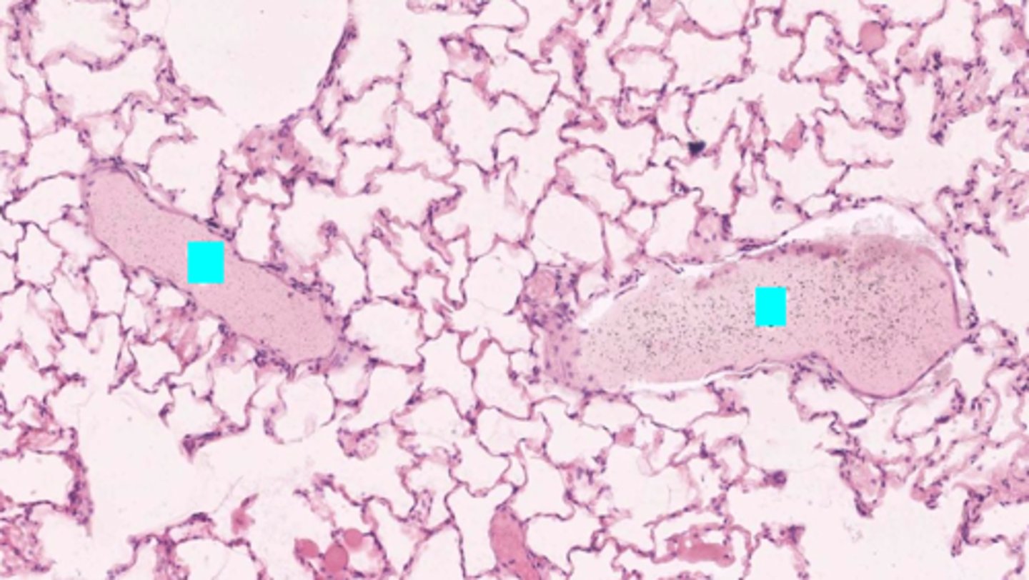 <p>ID the structure:</p>