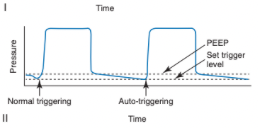 <ul><li><p><span>Occurs when a breath is delivered by the ventilator because of a change in airway pressure or flow not caused by patient effort</span></p><ul><li><p><span>Most often due to an inappropriately small threshold/sensitivity setting</span></p></li><li><p><span>Alternatively, flow or pressure distortions may be due to other factors, including circuit leaks, fluid/secretions within the circuit, or cardiac oscillations</span></p></li><li><p><span>Auto-triggering is more common when there are prolonged periods of no expiratory flow between breaths</span></p></li></ul></li></ul><p></p>