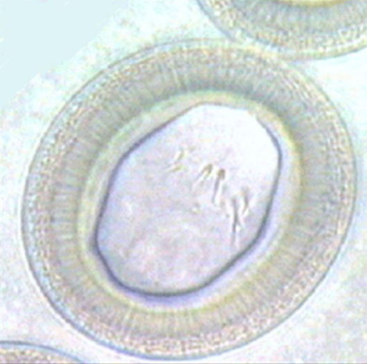 <p>In feces or segment squash from dogs</p>