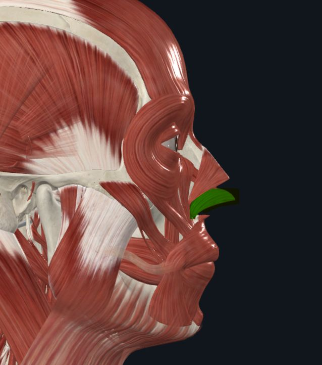 <p><strong>Nombre alterno: </strong>Músculo dilatador de la nariz</p><p><strong><mark data-color="yellow" style="background-color: yellow; color: inherit">Origen: </mark></strong><mark data-color="yellow" style="background-color: yellow; color: inherit">Borde posterior del cartílago del ala de la nariz</mark></p><p><strong><mark data-color="blue" style="background-color: blue; color: inherit">Inserción: </mark></strong><mark data-color="blue" style="background-color: blue; color: inherit">Piel del cartílago de la nariz</mark></p><p><strong><mark data-color="red" style="background-color: red; color: inherit">Acción:</mark></strong><mark data-color="red" style="background-color: red; color: inherit"> Dilata transversalmente las narinas</mark></p><p><strong><mark data-color="purple" style="background-color: purple; color: inherit">Inervación: </mark></strong><mark data-color="purple" style="background-color: purple; color: inherit">Nervio Facial</mark><strong><br><mark data-color="green" style="background-color: green; color: inherit">Relaciones: </mark></strong><mark data-color="green" style="background-color: green; color: inherit">Por fuera con piel, por dentro por cartílago de nariz</mark></p><p><strong>Notas: </strong>Vestigial</p>