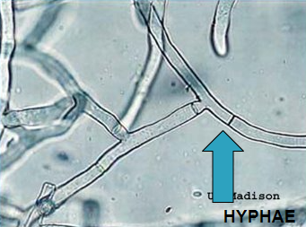 <p>most common in mold</p><p>septate: cross wall</p><p>non-septate: no cross wall</p><p>pauciseptate: rare cross walls (zygomyces)</p>