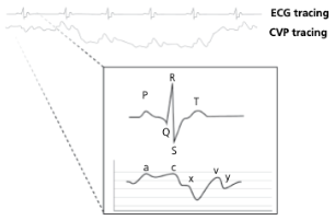 <p>Early atrial filling, while tricuspid valve is closed</p>