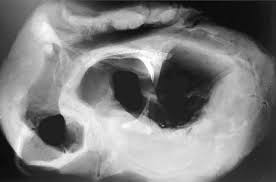 <p>Visceral Skeleton (random bones)</p>