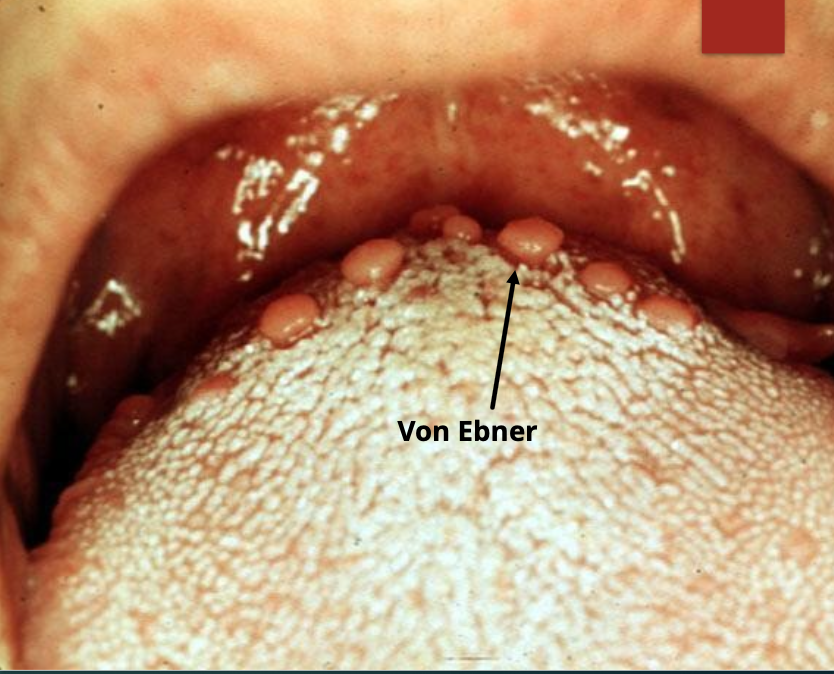 <p>Name the minor salivary glands</p>