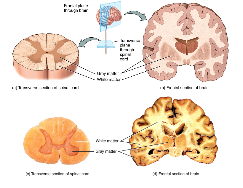 <ul><li><p>gray = regions with many cell bodies and dendrites</p></li><li><p>white = regions with many axons </p></li></ul><p></p>