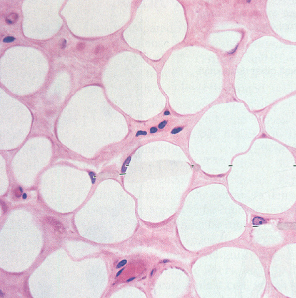 <p>1. 90% of mass consists of fat cells<br>2. highly vascularized <br>3. removes lipids from the bloodstream after meals and later releases them into the blood as needed<br>4. occurs in the HYPODERMIS and the MESENTERIES (sheets of serous membrane that hold the stomach and intestine in place)</p>
