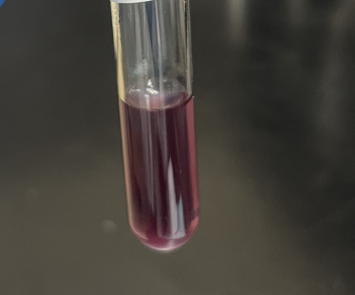 <p>lysine decarboxylase</p>
