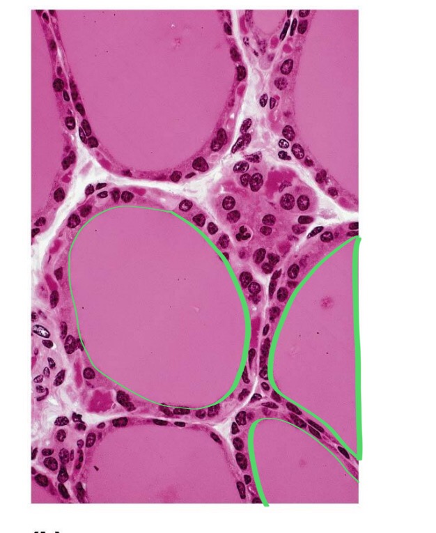 <p>Thyroid gland </p>