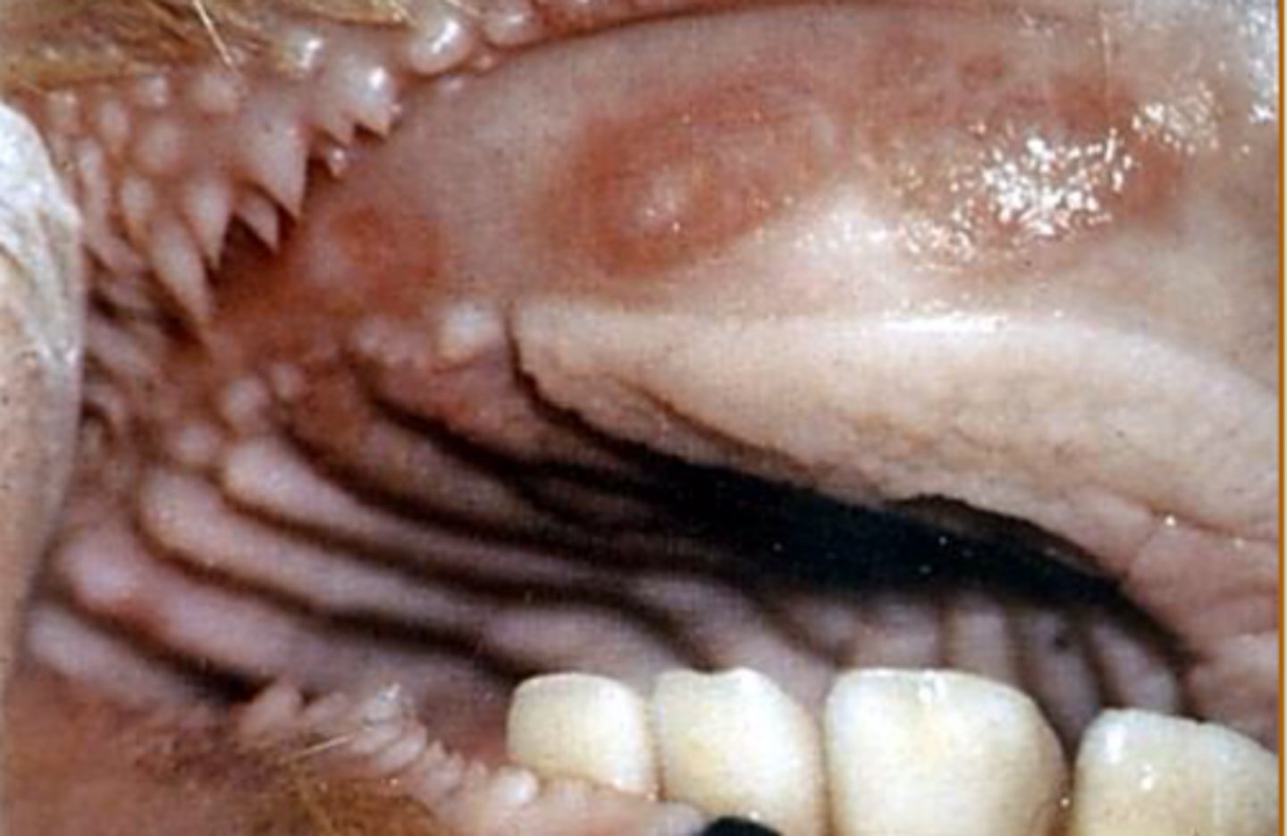 <p>What is an important differential of bovine papular stomatitis?</p>