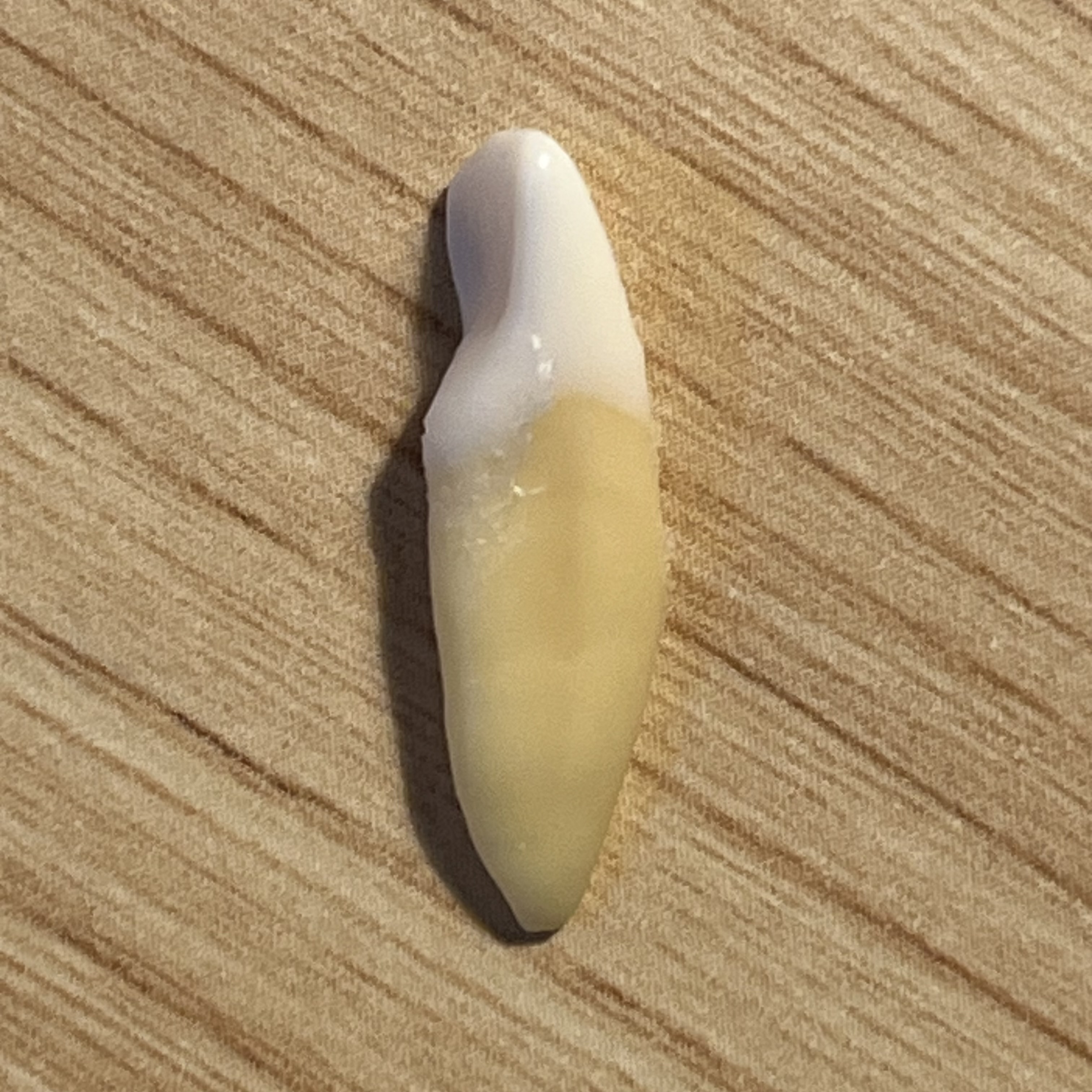 <p>What tooth is this (with view)?</p>