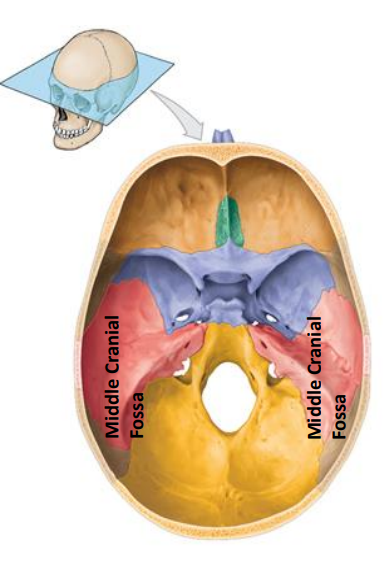 <p>Extends of the posterior nasal apertures to the petrous part of the temporal bones</p><ul><li><p>Sphenoid</p></li><li><p>Temporal</p></li><li><p>Parietal bones</p></li></ul><p>Contains:</p><ul><li><p>Temporal lobe, diencephalon, brain stem</p></li></ul>