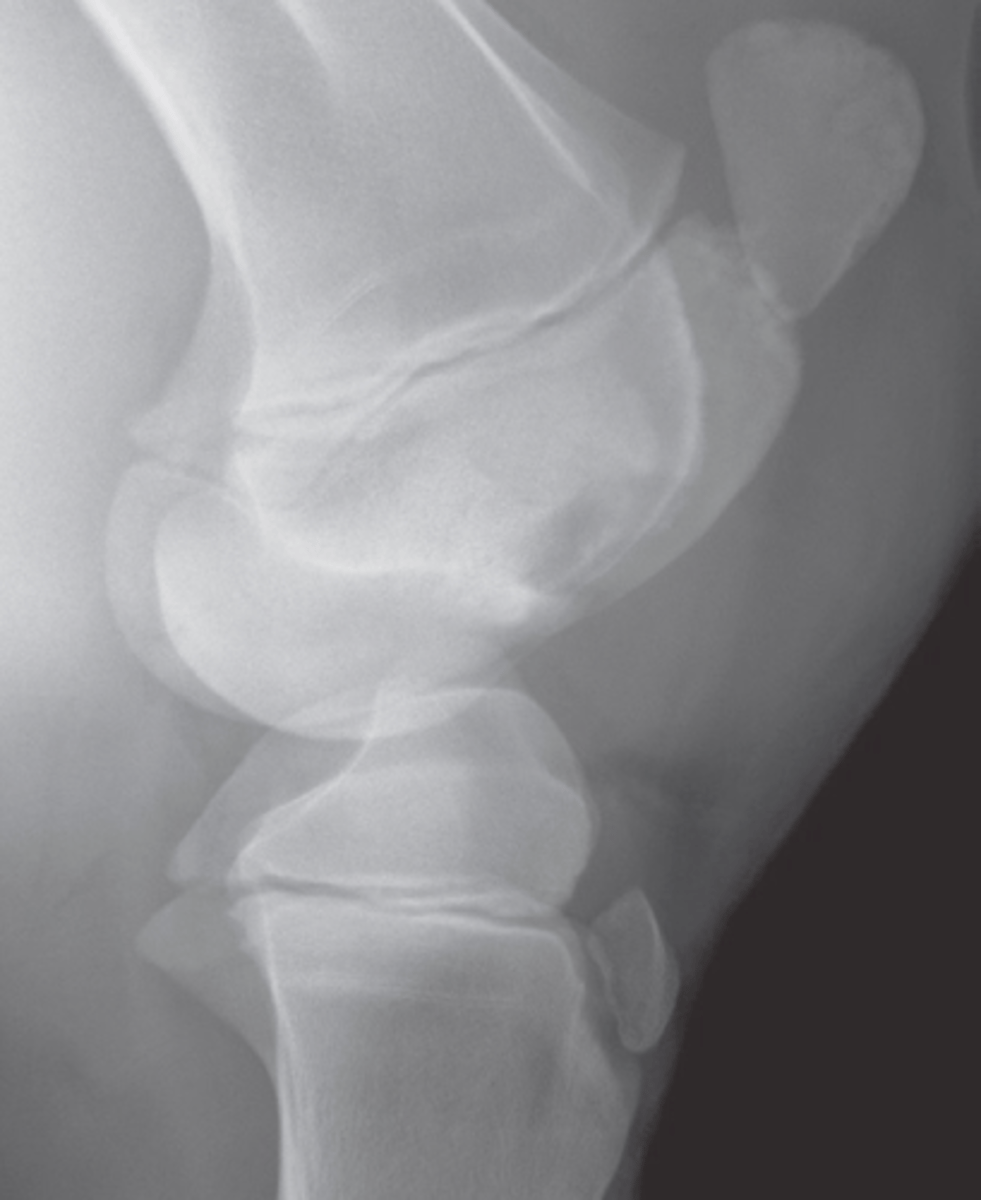 <p>Identify the type of infection?</p>