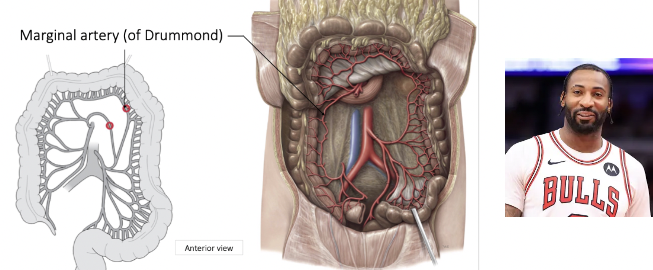 <p>Anastomoses between right, middle and left colic arteries - Creates circumference artery around entire large intestine</p><ul><li><p>﻿﻿Key for collateral circulation or alternative supply (compensatory measure)</p><ul><li><p>A pathogen can turn the marginal artery into a hazard as it can spread across whole area</p></li></ul></li></ul>