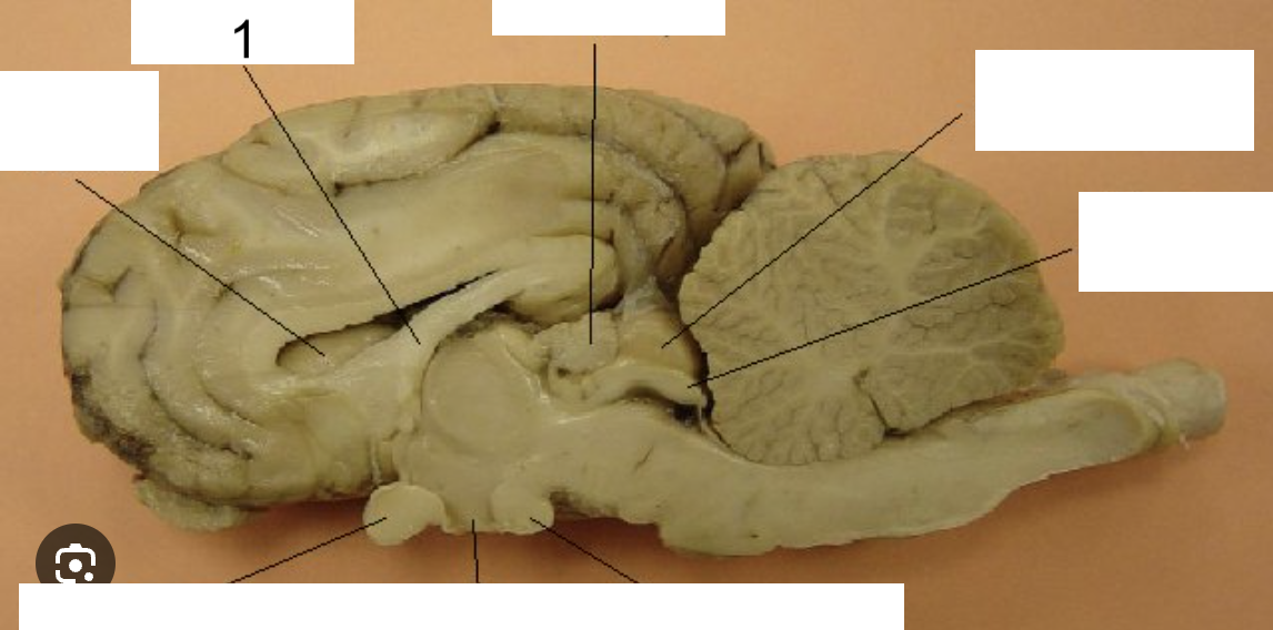 <p>What structure of the brain is this?</p>