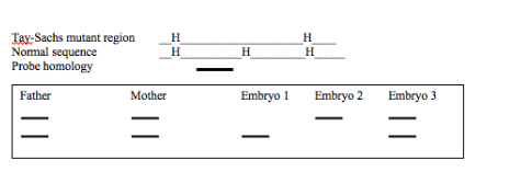 <p><span>A widespread mutant allele for Tay-Sachs disease lacks a HindIII restriction site in the gene sequence. HindIII restriction sites are indicated by “H” in the diagram. A probe is available for this region, with the homology shown in figure A. A couple, both carriers, is conceiving a child through in vitro fertilization and requests pre-implantation diagnosis of three embryos E1, E2, E3 to determine if the child will have Tay-Sachs, as shown in the autoradiogram Southern blot) (lower pat of figure, smaller fragments at the bottom of the gel)). What are you able to advise the parents?</span></p><p><span>a) Embryo 1 is free of the Tay-Sachs mutation</span></p><p><span>b) Embryo 2 is free of the Tay-Sachs mutation</span></p><p><span>c) Embryo 3 is free of the Tay-Sachs mutation</span></p><p><span>d) All embryos free of the Tay-Sachs mutation</span></p><p><span>e) No embryos are free of the Tay-Sachs mutation </span></p>