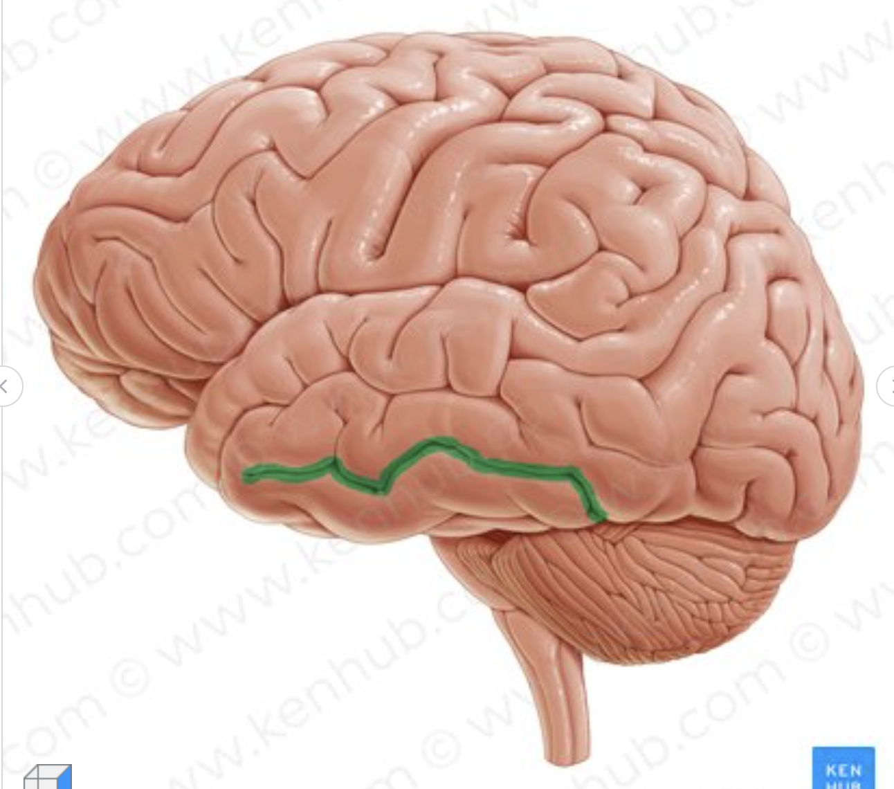 <p>Which is the sulcus in green?</p>