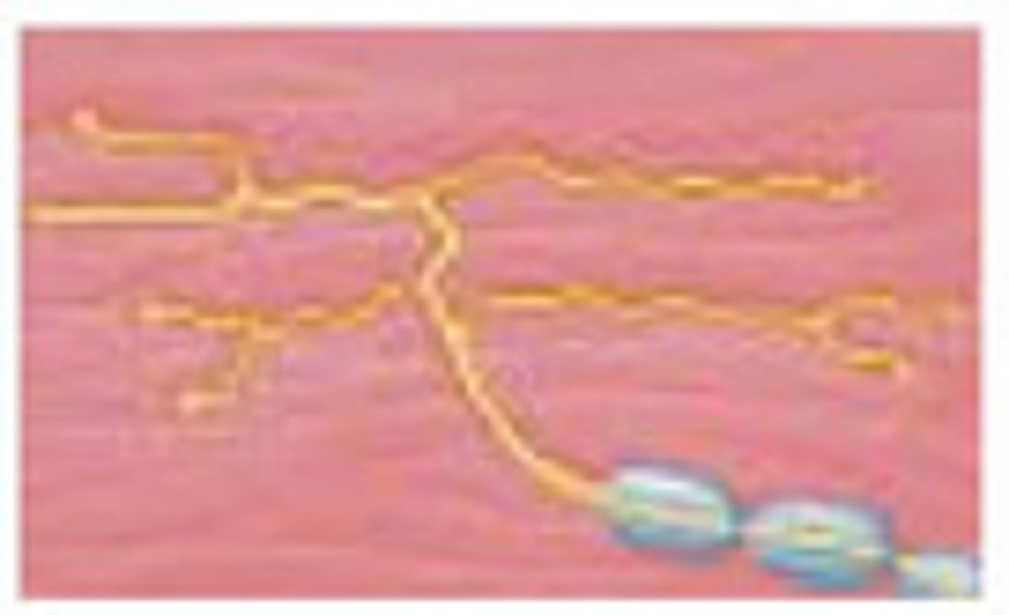 <p>Bare dendritic endings (no connective tissue wrapping) abundant in epithelia and connective tissues.; Mostly unmyelinated C fibers (slow, dull pain/temperature) or lightly myelinated Aδ fibers (sharp, fast pain).</p>