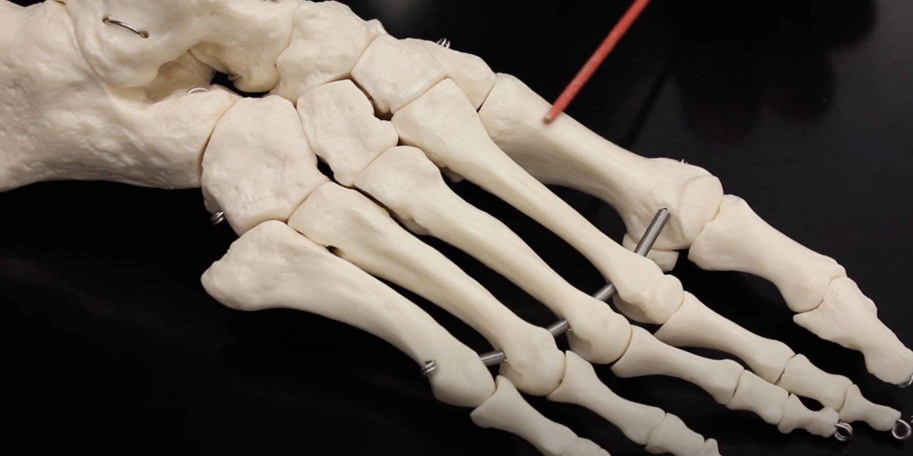 <p>Connecting tarsals to phalanges for big toe.</p>