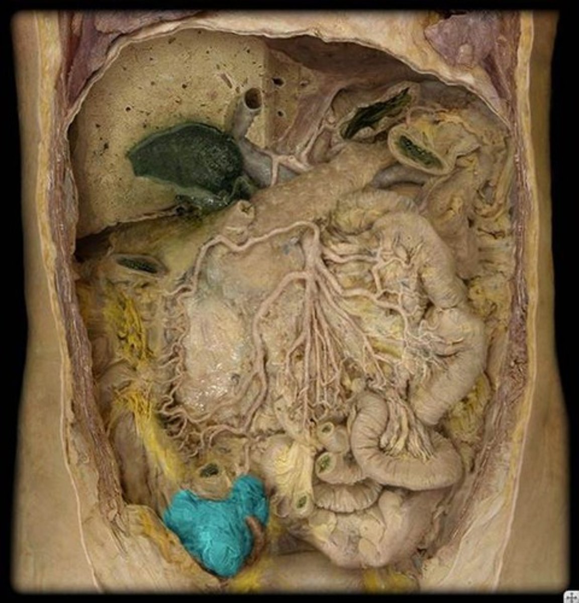 <p>Name this part of the large intestine.</p>